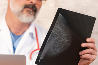 A mamografia de controle é fundamental para acompanhar alterações e garantir um diagnóstico seguro, explica Vinicius Tadeu Sattin Rodrigues.