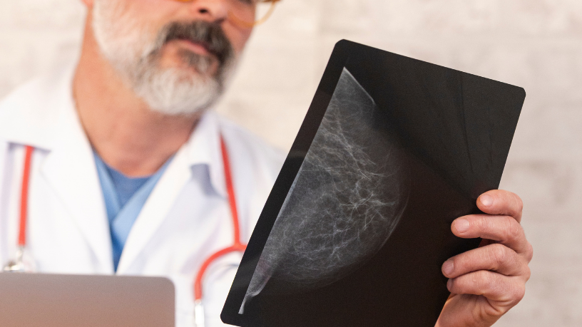 A mamografia de controle é fundamental para acompanhar alterações e garantir um diagnóstico seguro, explica Vinicius Tadeu Sattin Rodrigues.